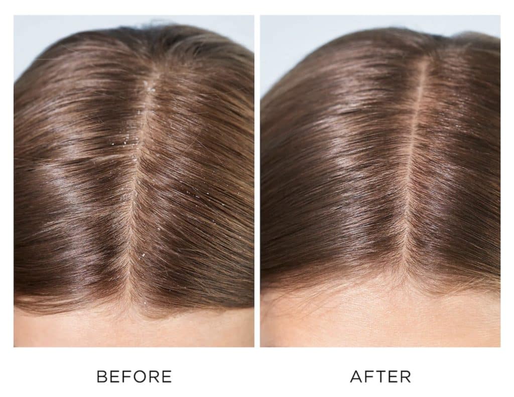 Briogeo Hair Care Review