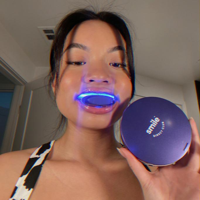 Smile Direct Club vs Byte Review