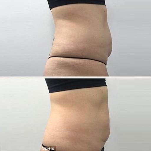 ProLon Before and After